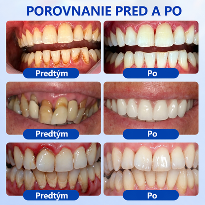 🦷🥑𝑮𝒍𝒊𝒎𝒎𝒆𝒓𝒍𝒚® 🦷 𝑮𝒖𝒎𝑹𝒆𝒗𝒊𝒗𝒆 – gél na obnovu parodontu
