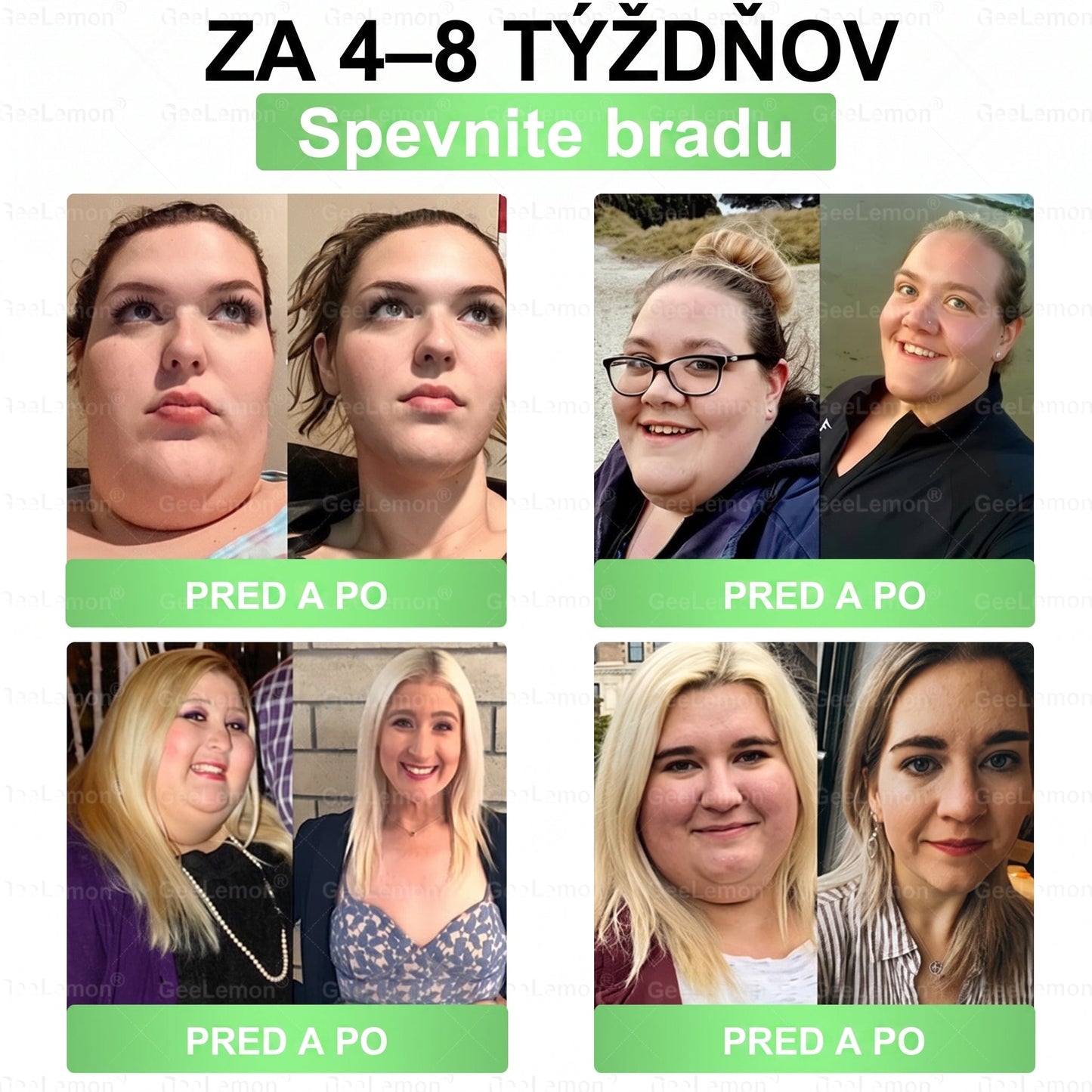 Oficiálne certifikované na Slovensku 🌼Tisíce spokojných používateľov na Slovensku🔥 𝐆𝐞𝑒𝐋𝐞𝐦𝐨𝐧® 𝐆𝐥𝐮𝐦𝐚𝐬𝐞𝐭𝐢𝐝𝐞 8 IN 1" TENKÝ A ZDRAVÝ MIKROIHLIČKOVÝ NÁPLASŤ ((Len raz denne, viditeľné zmeny už do 7 dní)) ✅