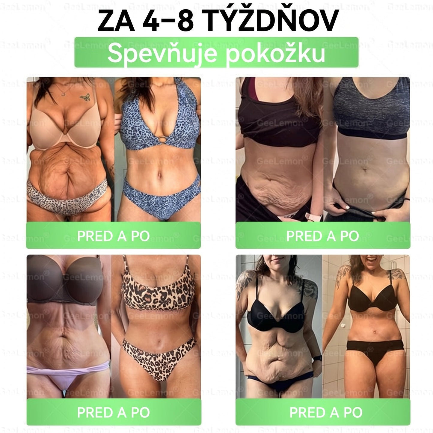 Oficiálne certifikované na Slovensku 🌼Tisíce spokojných používateľov na Slovensku🔥 𝐆𝐞𝑒𝐋𝐞𝐦𝐨𝐧® 𝐆𝐥𝐮𝐦𝐚𝐬𝐞𝐭𝐢𝐝𝐞 8 IN 1" TENKÝ A ZDRAVÝ MIKROIHLIČKOVÝ NÁPLASŤ ((Len raz denne, viditeľné zmeny už do 7 dní)) ✅
