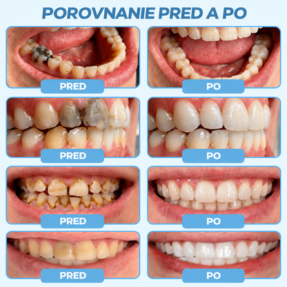 🌿𝑮𝒍𝒊𝒎𝒎𝒆𝒓𝒍𝒚®  𝑮𝒖𝒎𝑹𝒆𝒗𝒊𝒗𝒆 – gél na obnovu parodontu