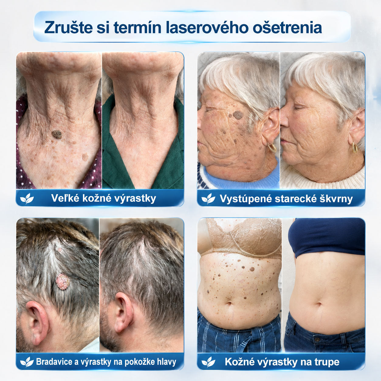 🍧𝐎𝐟𝐢𝐜𝐢á𝐥𝐧𝐚 𝐩𝐫𝐞𝐝𝐚𝐣ň𝐚 𝐳𝐧𝐚č𝐤𝐲 𝐏𝐢𝐜𝐝𝐨® 𝟕-𝐝ň𝐨𝐯ý 𝐨𝐝𝐬𝐭𝐫𝐚ň𝐨𝐯𝐚č   𝐤𝐨ž𝐧ý𝐜𝐡 𝐯ý𝐫𝐚𝐬𝐭𝐤𝐨𝐯 𝐚 š𝐤𝐯𝐫𝐧(𝐑𝐨𝐥𝐥𝐞𝐫𝐛𝐚𝐥𝐥 𝐛𝐞𝐳 𝐛𝐨𝐥𝐞𝐬𝐭𝐢, 𝐛𝐞𝐳 𝐣𝐚𝐳𝐢𝐞𝐯)