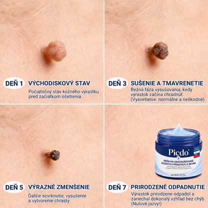 👨‍⚕️🌼Picdo® 7-dňový krém na odstránenie kožných výrastkov (receptúra bez bolesti a jaziev)