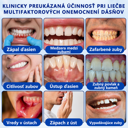 🦷🥑𝑮𝒍𝒊𝒎𝒎𝒆𝒓𝒍𝒚® 🦷 𝑮𝒖𝒎𝑹𝒆𝒗𝒊𝒗𝒆 – gél na obnovu parodontu