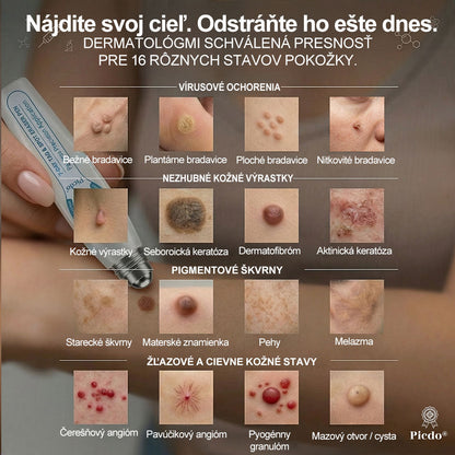 🍧𝐎𝐟𝐢𝐜𝐢á𝐥𝐧𝐚 𝐩𝐫𝐞𝐝𝐚𝐣ň𝐚 𝐳𝐧𝐚č𝐤𝐲 𝐏𝐢𝐜𝐝𝐨® 𝟕-𝐝ň𝐨𝐯ý 𝐨𝐝𝐬𝐭𝐫𝐚ň𝐨𝐯𝐚č   𝐤𝐨ž𝐧ý𝐜𝐡 𝐯ý𝐫𝐚𝐬𝐭𝐤𝐨𝐯 𝐚 š𝐤𝐯𝐫𝐧(𝐑𝐨𝐥𝐥𝐞𝐫𝐛𝐚𝐥𝐥 𝐛𝐞𝐳 𝐛𝐨𝐥𝐞𝐬𝐭𝐢, 𝐛𝐞𝐳 𝐣𝐚𝐳𝐢𝐞𝐯)