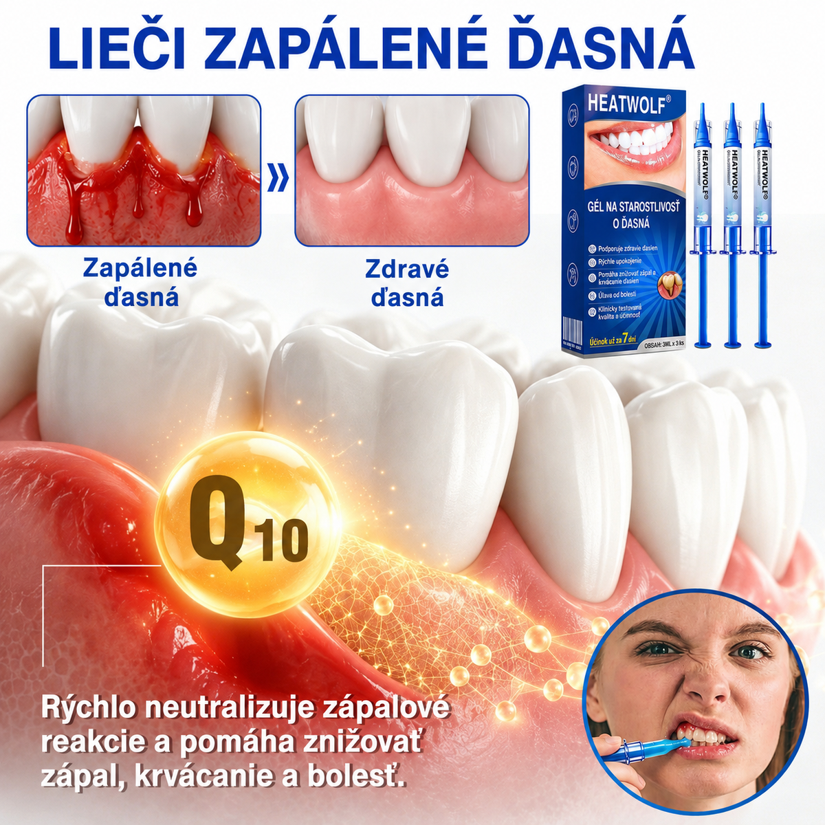 HEATWOLF® 👨‍⚕️🦷GumRevive Parodontálny opravný gél🍅