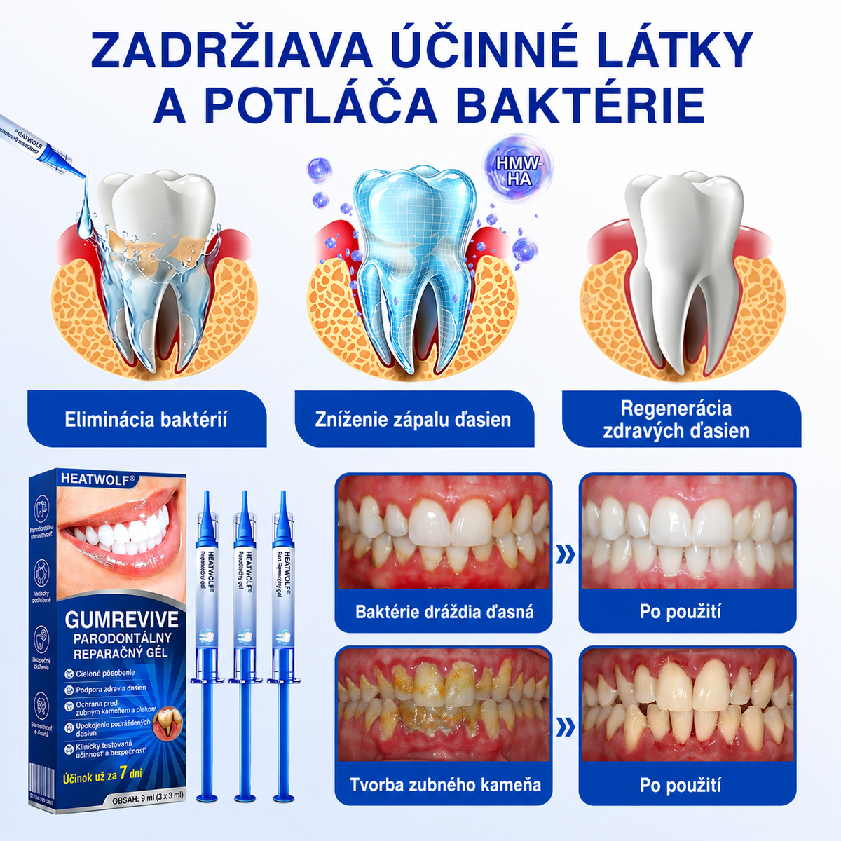 HEATWOLF® 👨‍⚕️🦷GumRevive Parodontálny opravný gél🍅