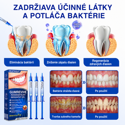 HEATWOLF® 👨‍⚕️🦷GumRevive Parodontálny opravný gél🍅
